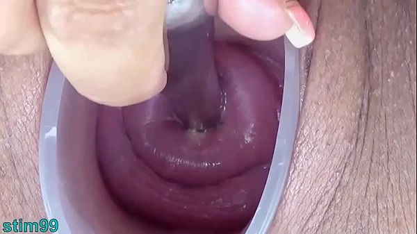 Uncensored Japanese Cervix Stretching and Uterus Dilation with Penetration